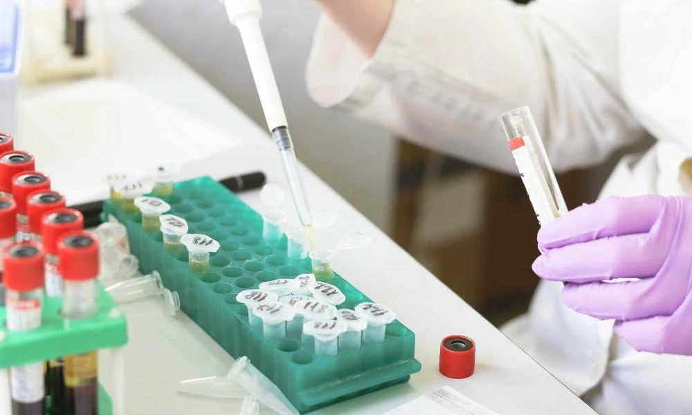 Ευλογιά των πιθήκων: Εξαπλώνεται σε παγκόσμια κλίμακα